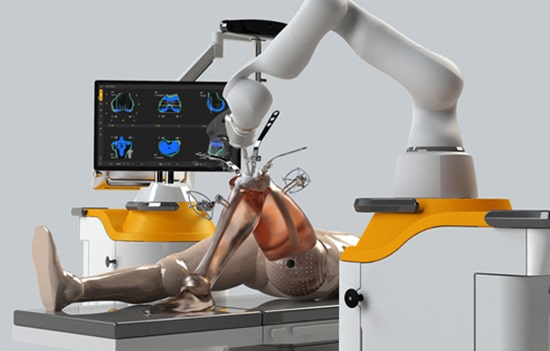 robotic-knee-replacement-surgery