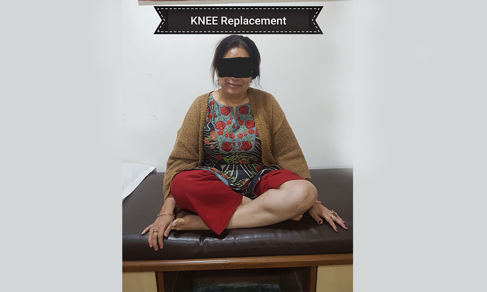 sitting-cross-leg-after-knee-replacemnt-surgery