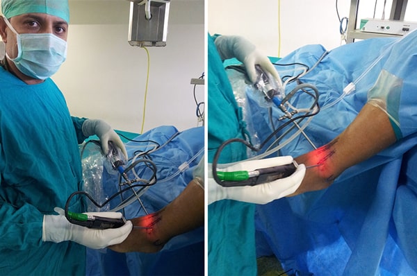 Ankle-Joint-Surger-By-Dr-Shekhar-Srivastav-1