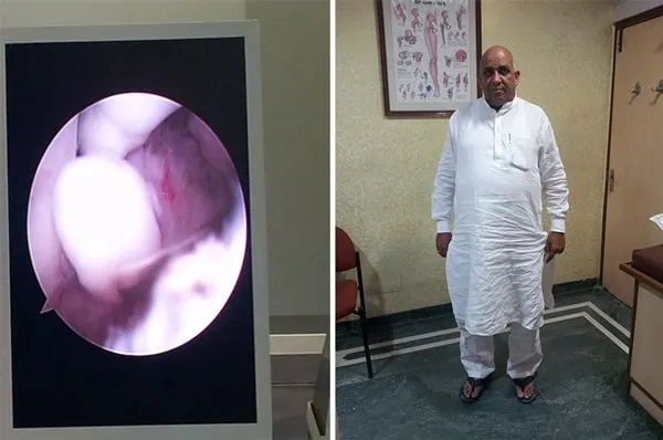 Ankle-Joint-Surger-By-Dr-Shekhar-Srivastav-2