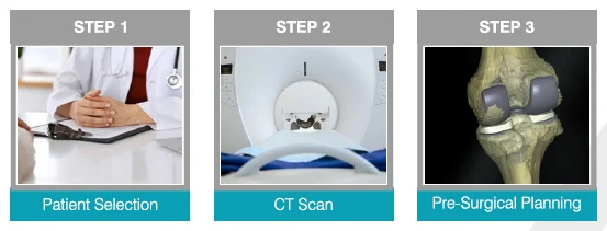 Knee-Joint-Replacement-Process-1
