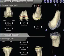 MRI-generated-3D-image-of-the-knee