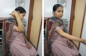 Patient-After-Elbow-Replacement
