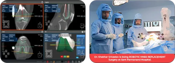 Robotic-Knee-Replacement-Surgery