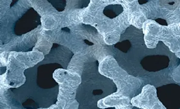 Trabecular-Metal