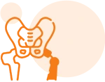 procedure